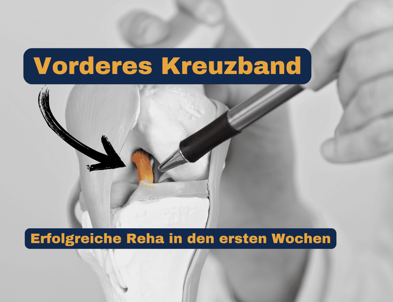 Kreuzbandriss: die ersten Wochen nach der OP